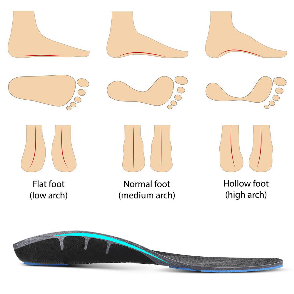 Why Arch Support WALKHERO